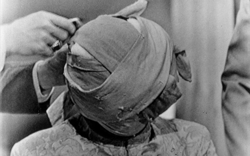 Man with bandages all around his head, black and white